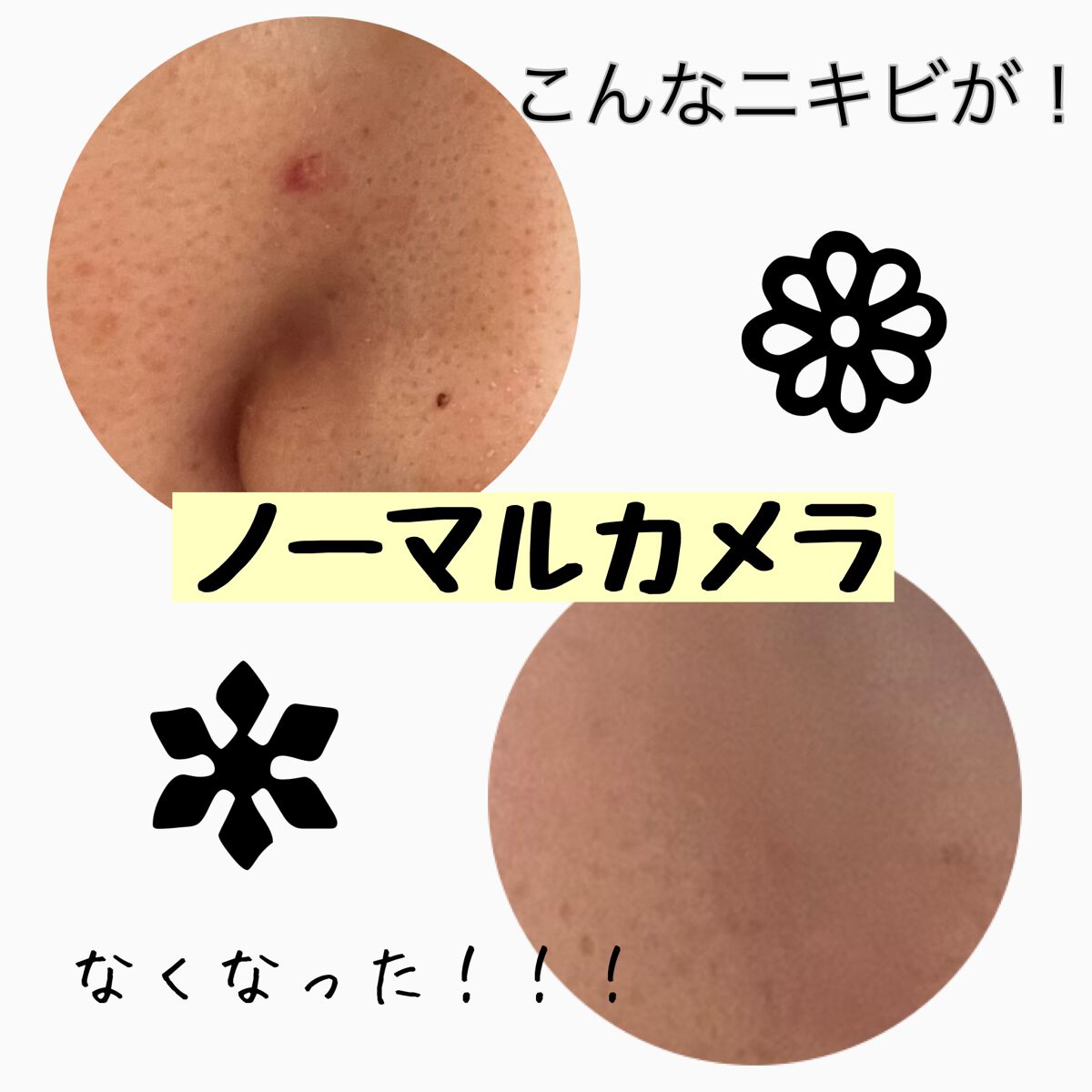 マジックティーツリーオイル/ブラン/フェイスオイルを使ったクチコミ(1枚目)