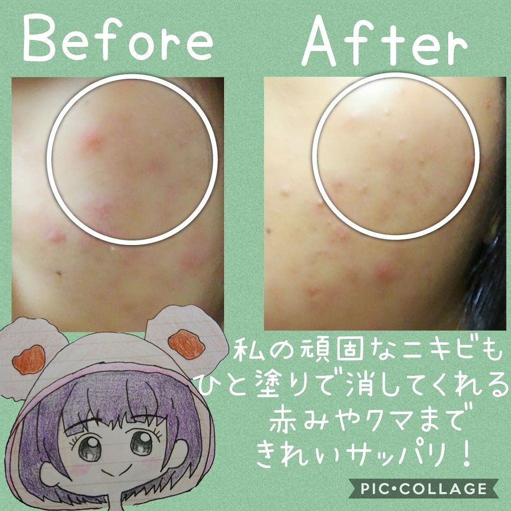 カラーミキシングコンシーラー C11 ピンク＆ライトベージュ/キャンメイク/パレットコンシーラーを使ったクチコミ（3枚目）