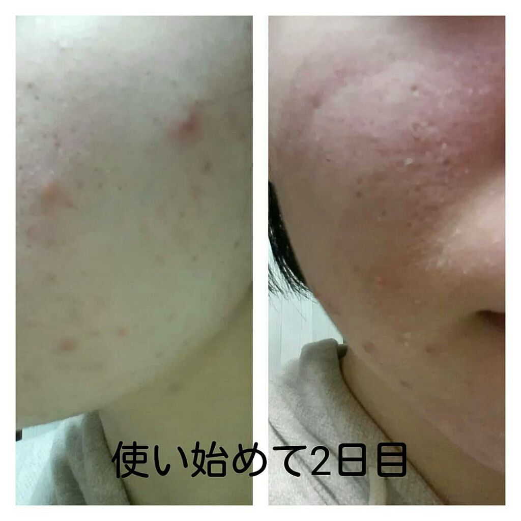 銀麦 on LIPS 「今回は株式会社イーズ・インターナショナルさんの「夜だけ美容断食..」(3枚目)