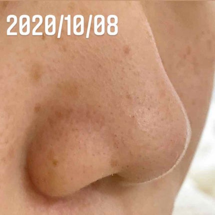 ホワイト もこもこ白泡マスク/リッツ/洗い流すパック・マスクを使ったクチコミ(4枚目)