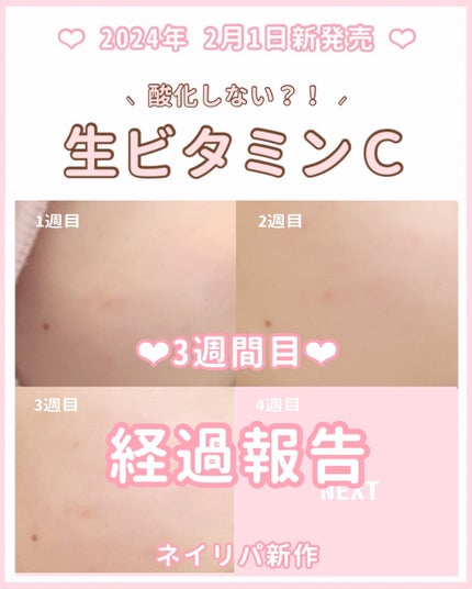 ビタペアC ビタレチ美容液/ネイチャーリパブリック/美容液を使ったクチコミ(1枚目)