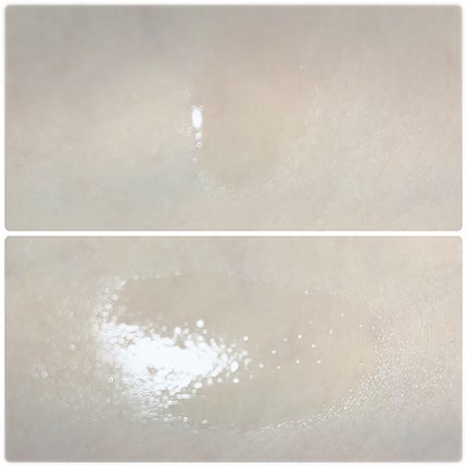 バイオイル/バイオイル/フェイスオイルを使ったクチコミ(3枚目)