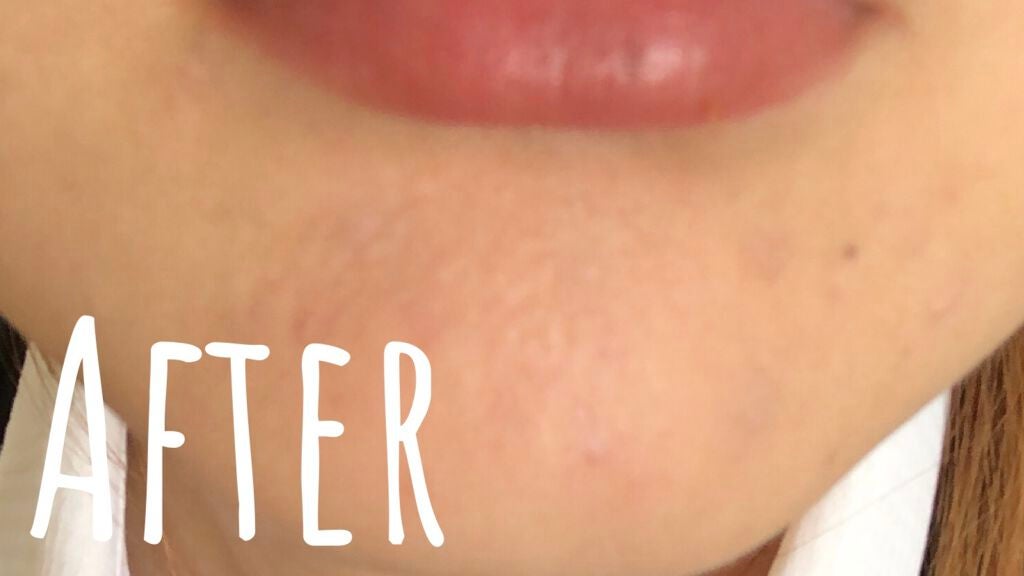 chiilol on LIPS 「✼••┈┈••✼••┈┈••✼••┈┈••✼••┈┈••✼この..」(3枚目)