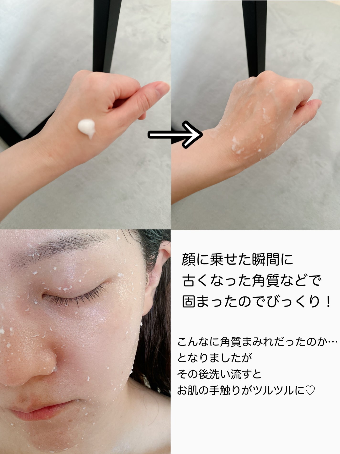 ブライトニングピーリングジェル/Dr.G/ピーリングを使ったクチコミ(3枚目)