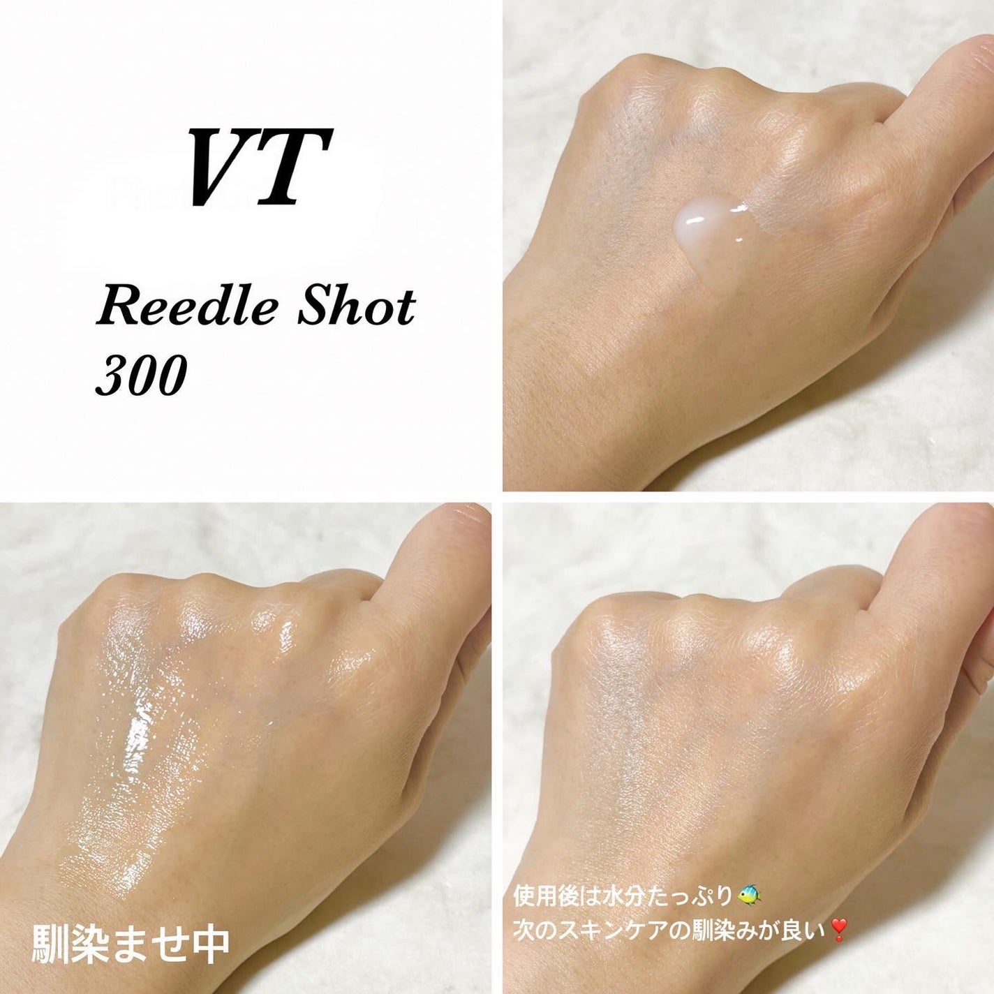 シカレチA エッセンス0.1/VT/美容液を使ったクチコミ(10枚目)