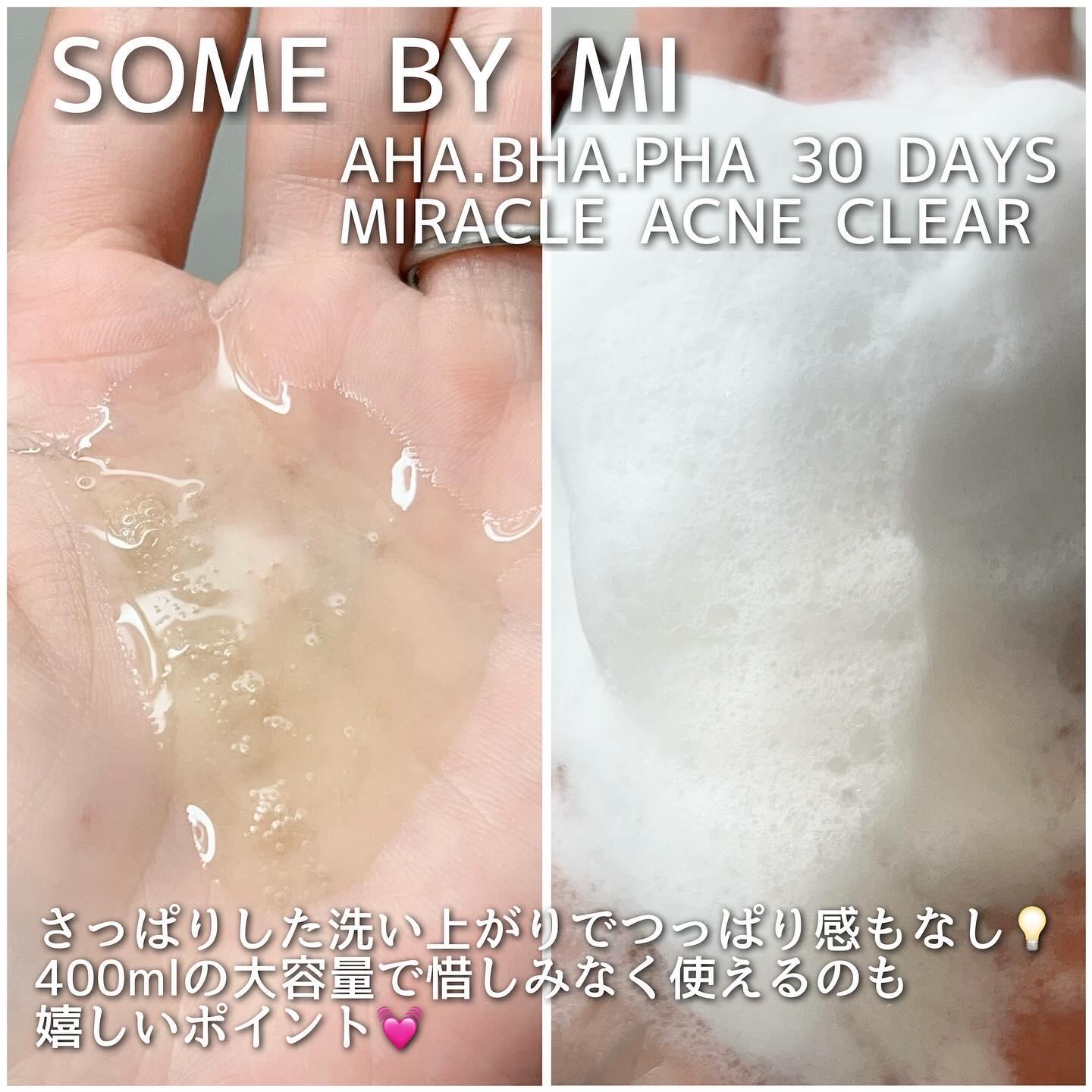 AHA·BHA·PHA 30デイズミラクルアクネボディクレンザー/SOME BY MI/ボディソープを使ったクチコミ（2枚目）