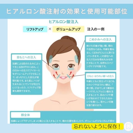じゅん on LIPS 「".@jun_mens_biyou←他の美容投稿もチェック!!..」(4枚目)