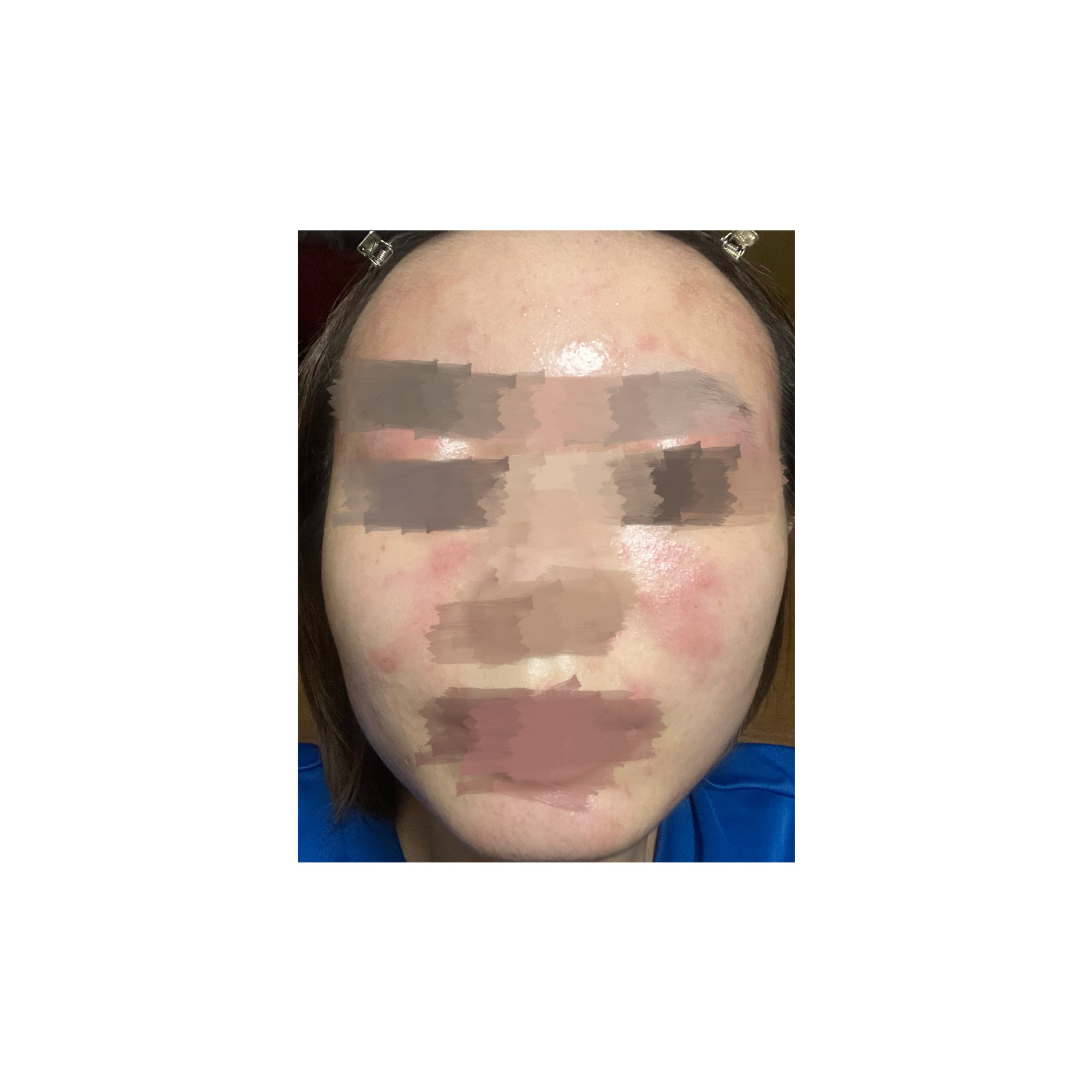 ローション/ピアベルピア/化粧水を使ったクチコミ（2枚目）