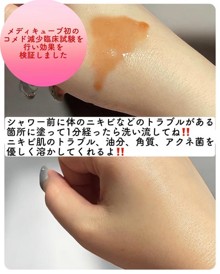 ボディアクネピーリングショット/MEDICUBE/ネック・デコルテケアを使ったクチコミ(4枚目)