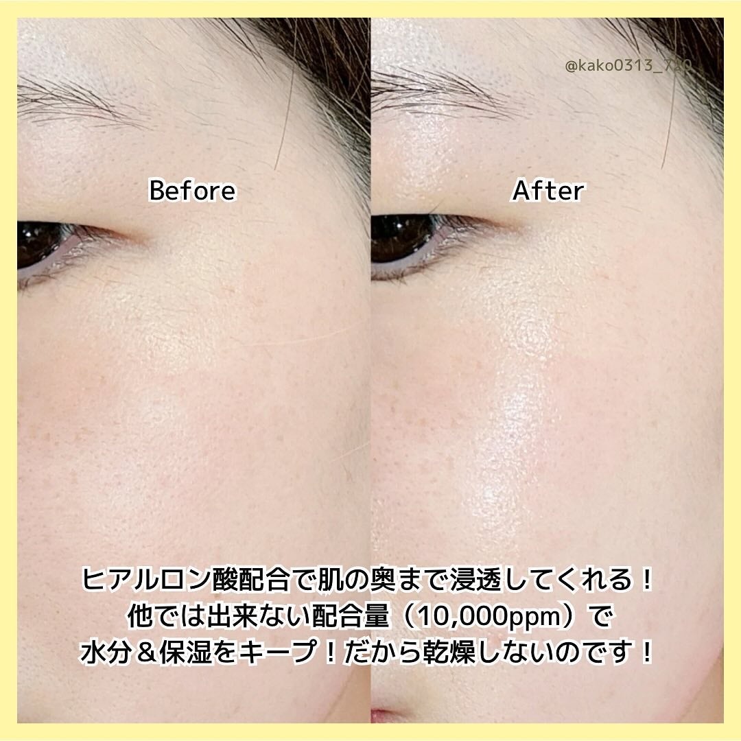 HA Boosting Serum /NATURAL DERMA PROJECT/ブースター・導入液を使ったクチコミ(6枚目)
