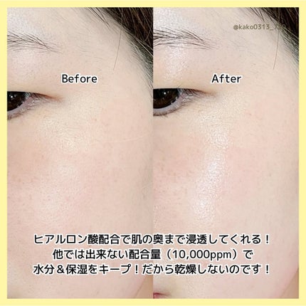 HA Boosting Serum /NATURAL DERMA PROJECT/ブースター・導入液を使ったクチコミ(6枚目)