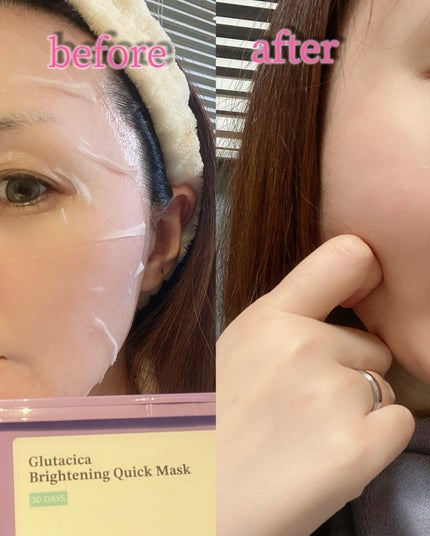 グルタシカ ブライトニングクイックマスク/Dr.Viuum/シートマスク・パックを使ったクチコミ(10枚目)
