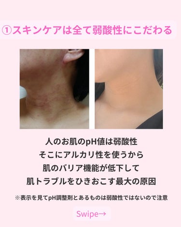 美肌カウンセラー💆綺麗のお助け相談所 on LIPS 「元重度のアトピーから誉められ艶肌への変貌🍀効果が実感できた３つ..」（3枚目）