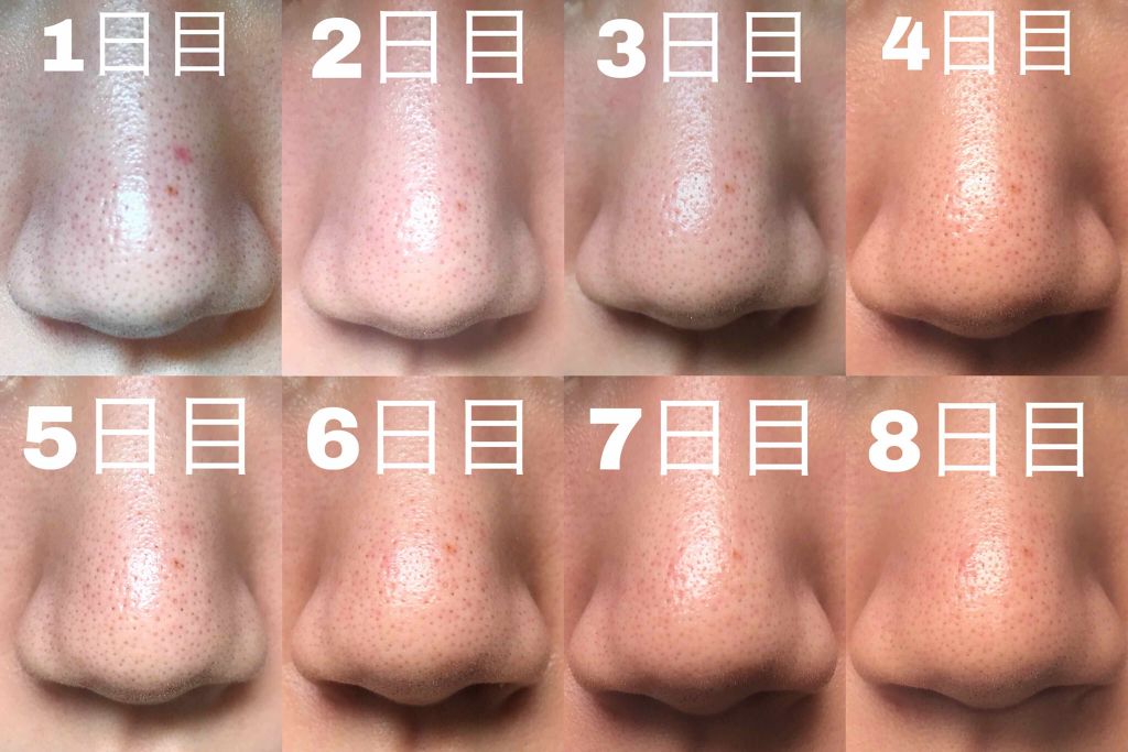 泥炭石 洗顔石鹸/ペリカン石鹸/洗顔石鹸を使ったクチコミ（3枚目）