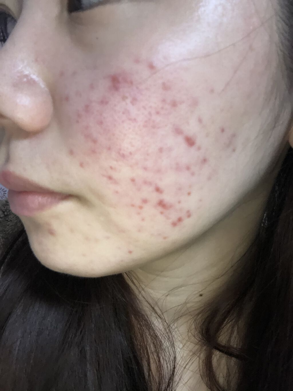 薬用 クリアローション M(しっとりタイプ)/オルビス/化粧水を使ったクチコミ（1枚目）