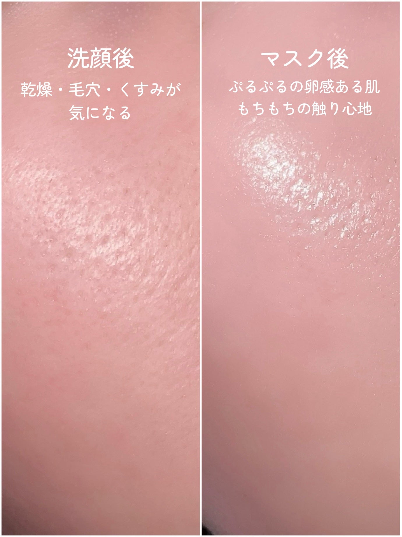 ティーツリーピュリファイングマスク/BONABELLA/洗い流すパック・マスクを使ったクチコミ(6枚目)