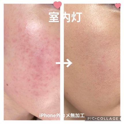 フィットミー コンシーラー/MAYBELLINE NEW YORK/リキッドコンシーラーを使ったクチコミ(5枚目)