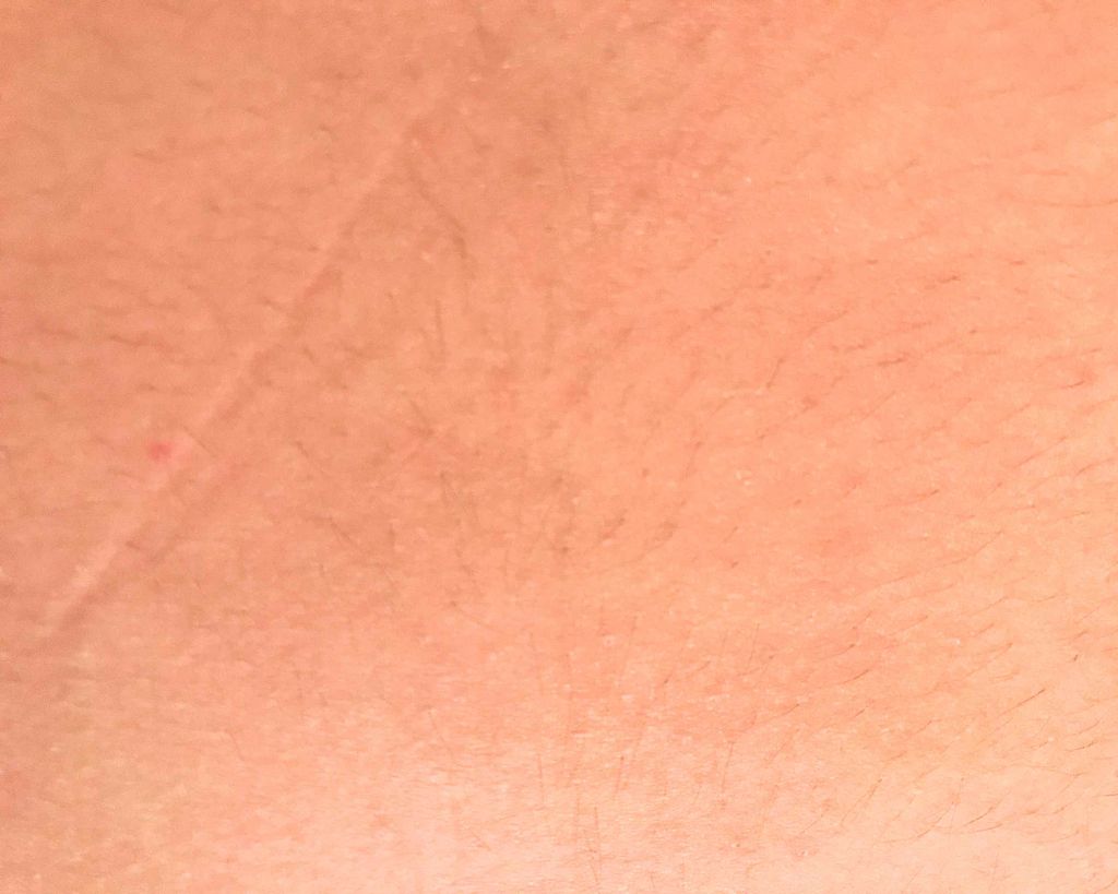 スムーズスキン/DAISO/ムダ毛ケアを使ったクチコミ（2枚目）