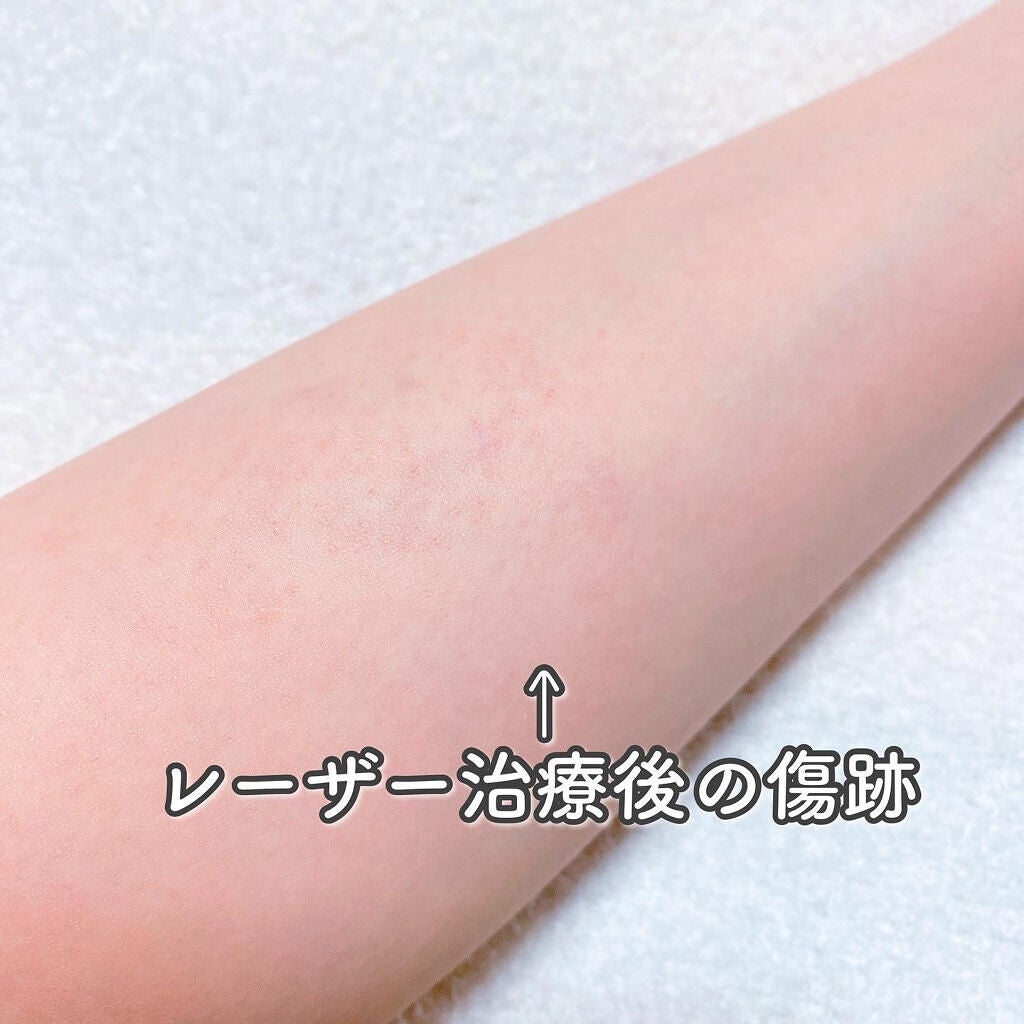 マーシュフィールド SC ボディカバーファンデN/マーシュ・フィールド/クリーム・エマルジョンファンデーションを使ったクチコミ(3枚目)