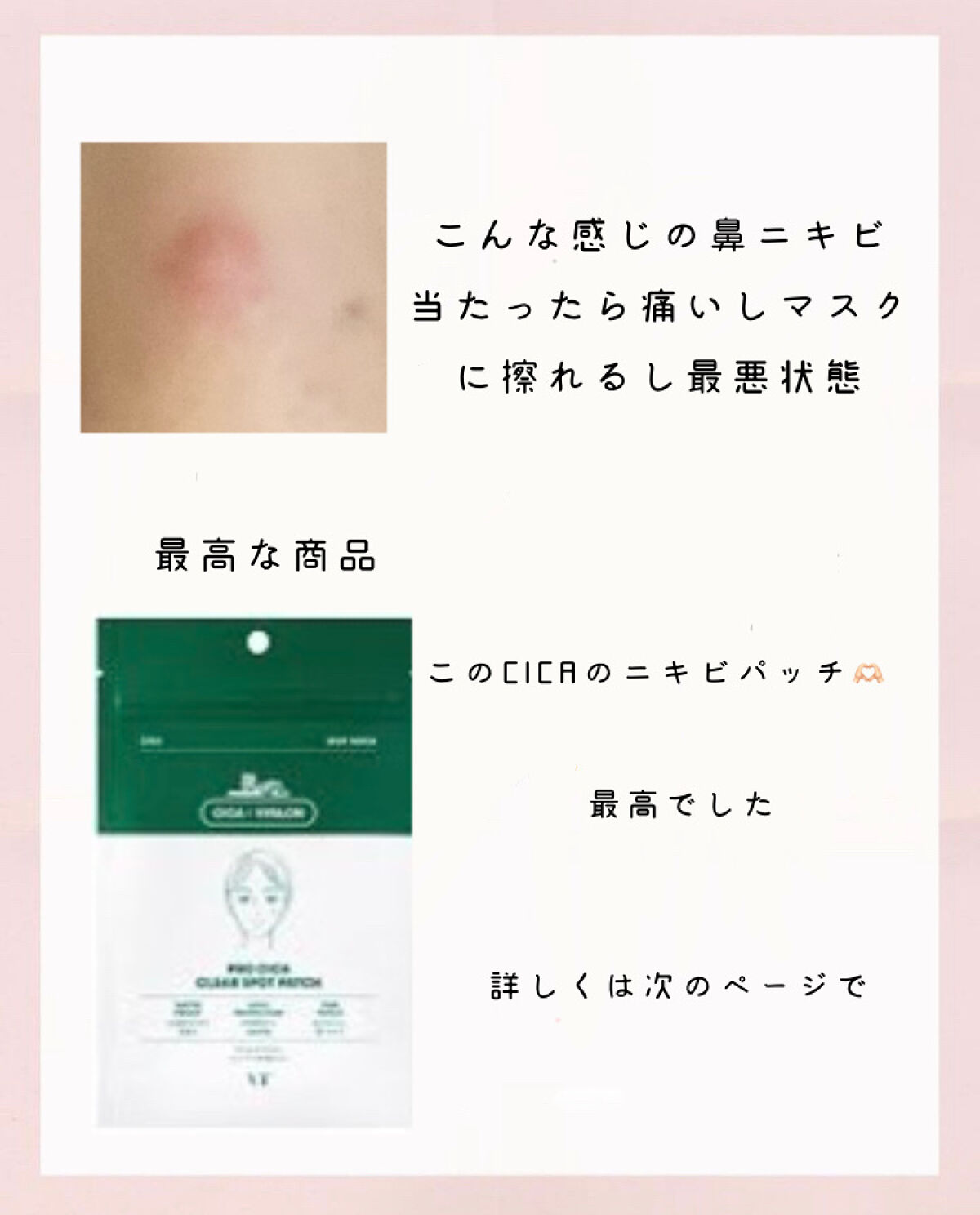 プロCICA クリアスポットパッチ/VT/その他スキンケアを使ったクチコミ（3枚目）