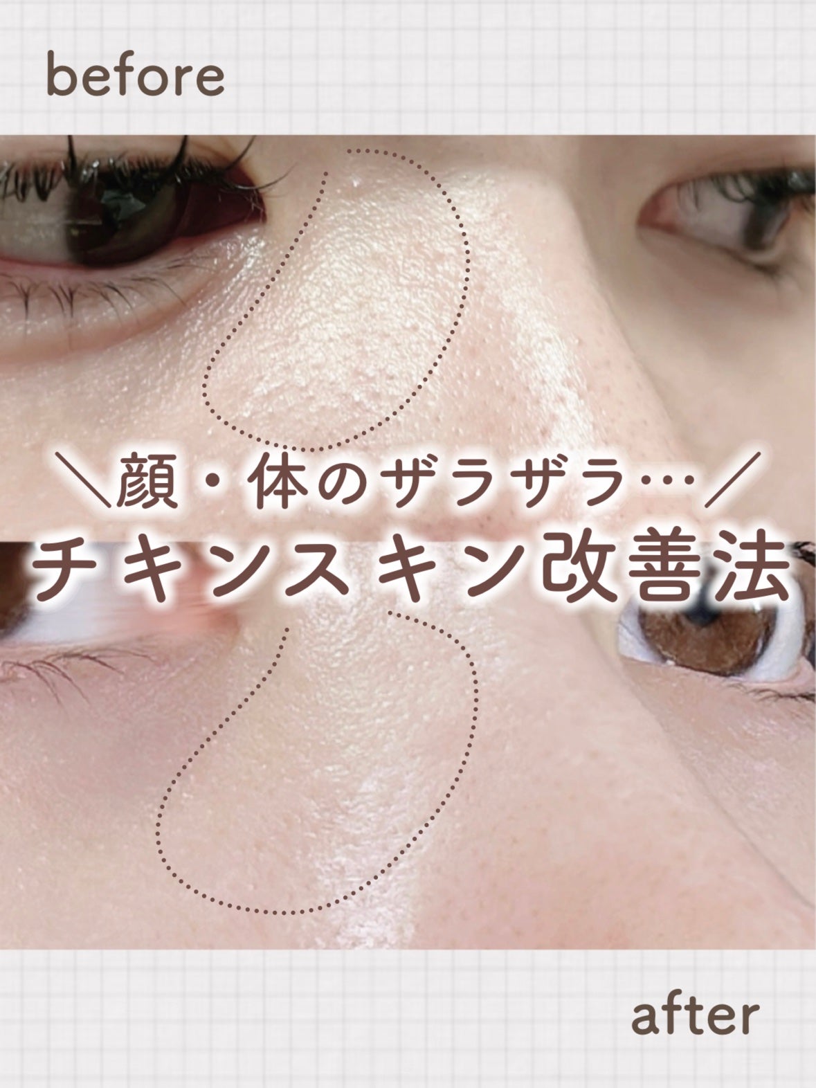 ガスール固形/ナイアード/洗顔フォームを使ったクチコミ(1枚目)