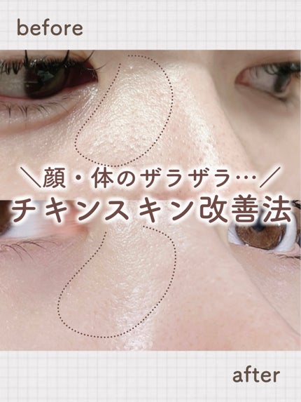 HADA method レチノペアクリーム/HADA method/ボディクリームを使ったクチコミ(1枚目)