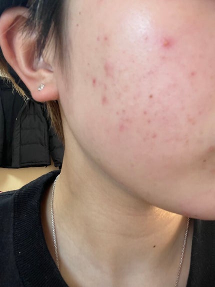 を使ったクチコミ(2枚目)