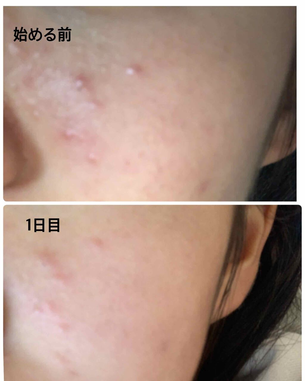 DHC ビタミンBミックス/DHC/美容サプリメントを使ったクチコミ（3枚目）