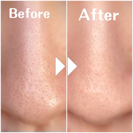 メイクアップ リムーバー オイル/MAISON LEXIA/オイルクレンジングを使ったクチコミ(8枚目)