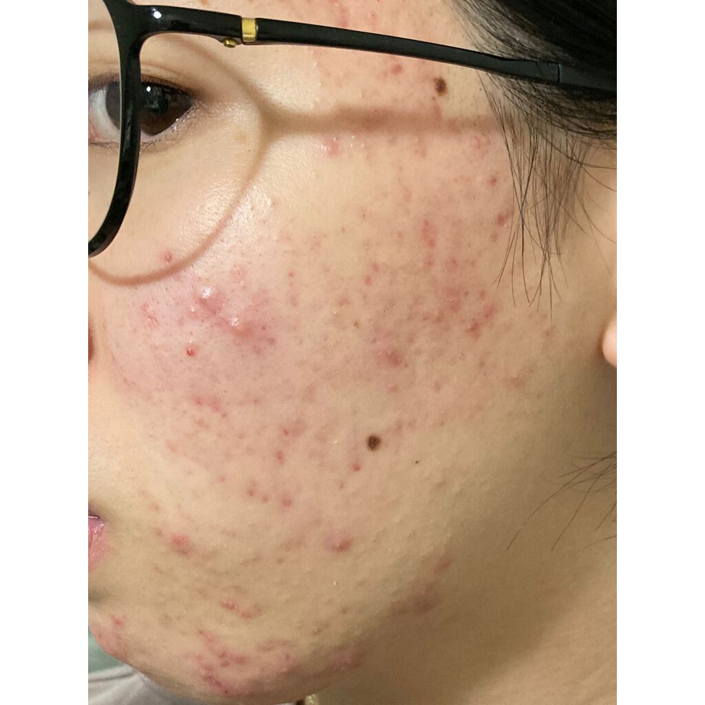 u on LIPS 「お久しぶりの投稿🦦ここ最近、本当に肌すごいことになっててやっぱ..」(2枚目)