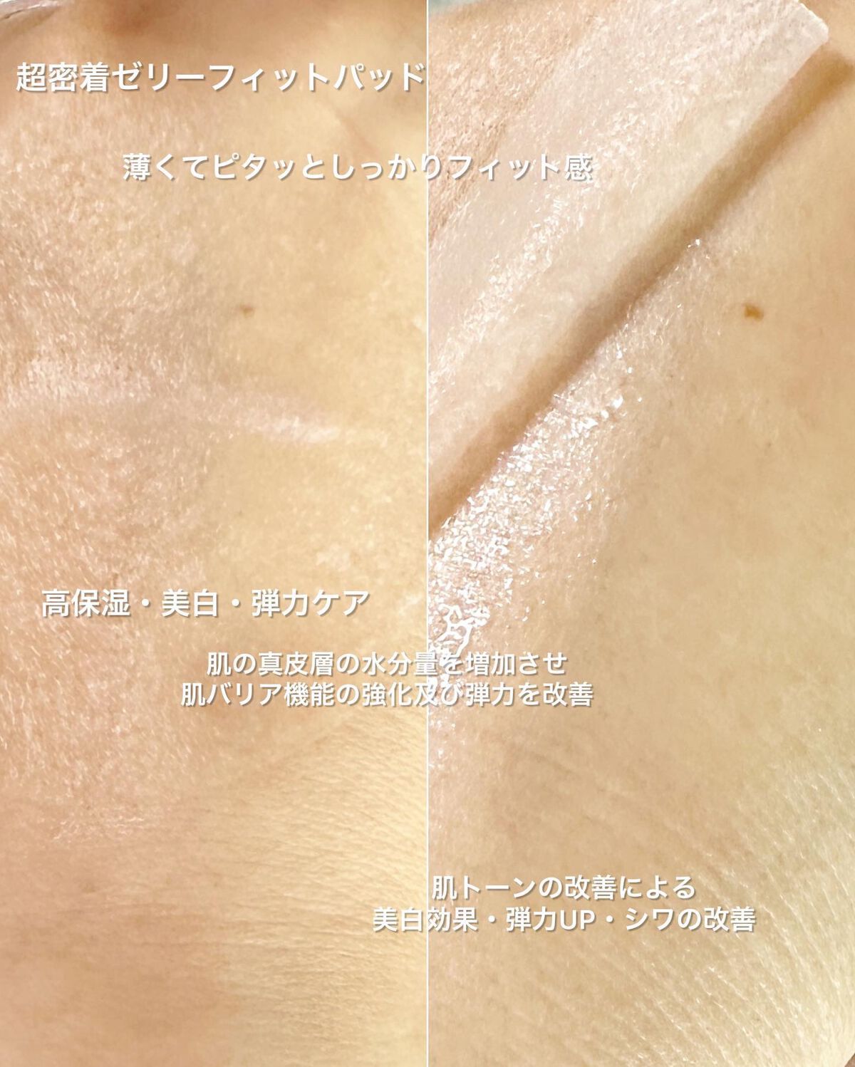 ヘルプミー! リアルコラーゲンパッド/One-day's you/トナーパッドを使ったクチコミ(8枚目)