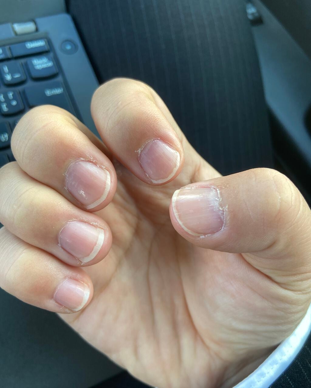 エテュセ クイックケアコート/ettusais/ネイルオイル・トリートメントを使ったクチコミ(3枚目)