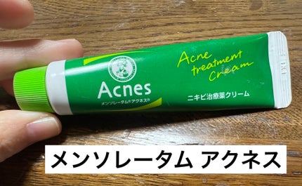 ニキビ治療薬(医薬品)/メンソレータム アクネス/その他を使ったクチコミ(1枚目)