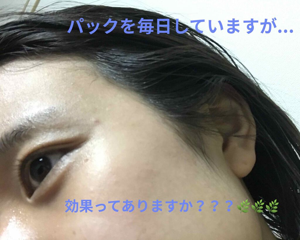 クリアターン ホワイト マスク (ビタミンC)/クリアターン/シートマスク・パックを使ったクチコミ（1枚目）