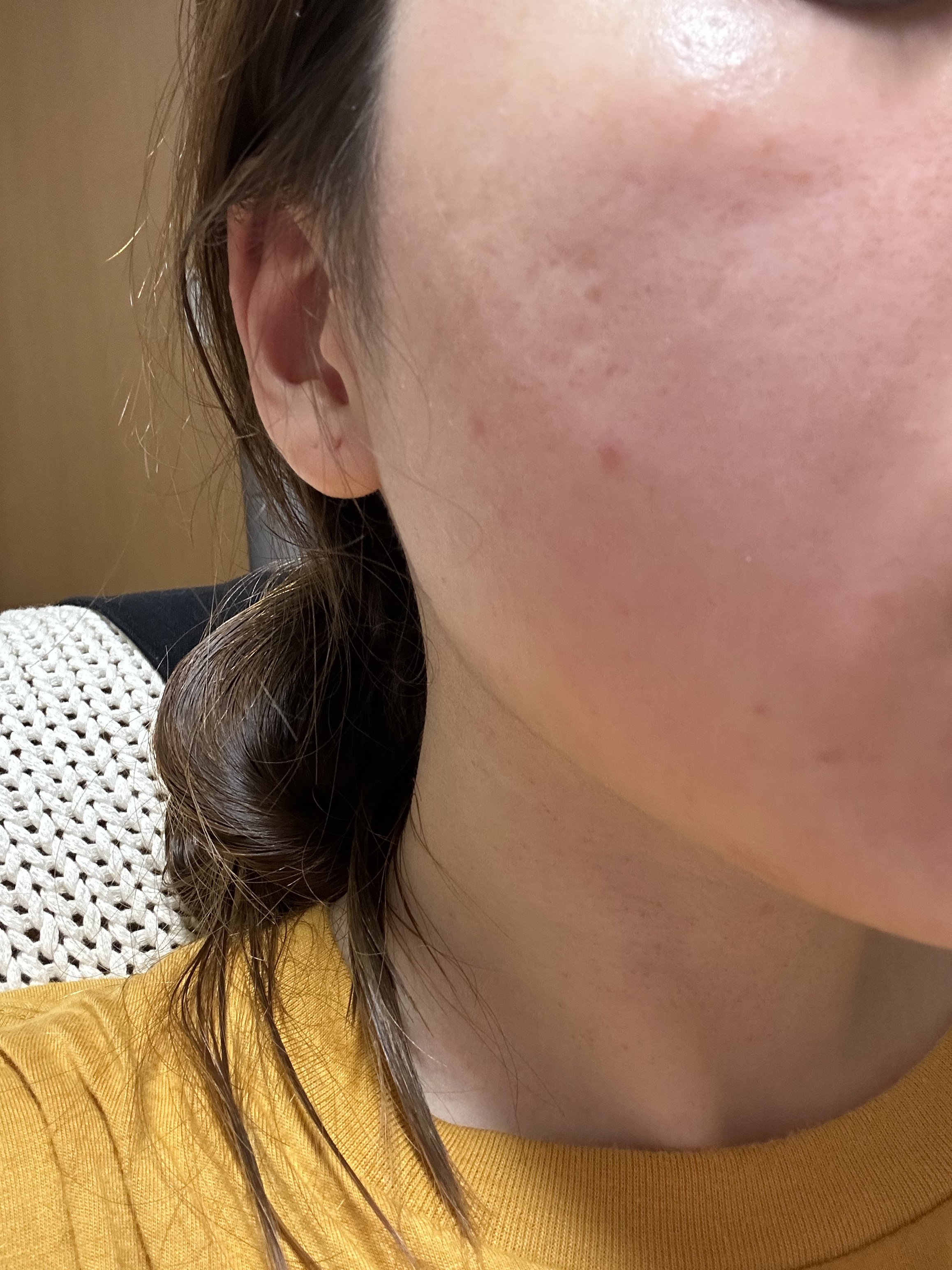 ベリーお元気？/ラッシュ/洗い流すパック・マスクを使ったクチコミ（2枚目）