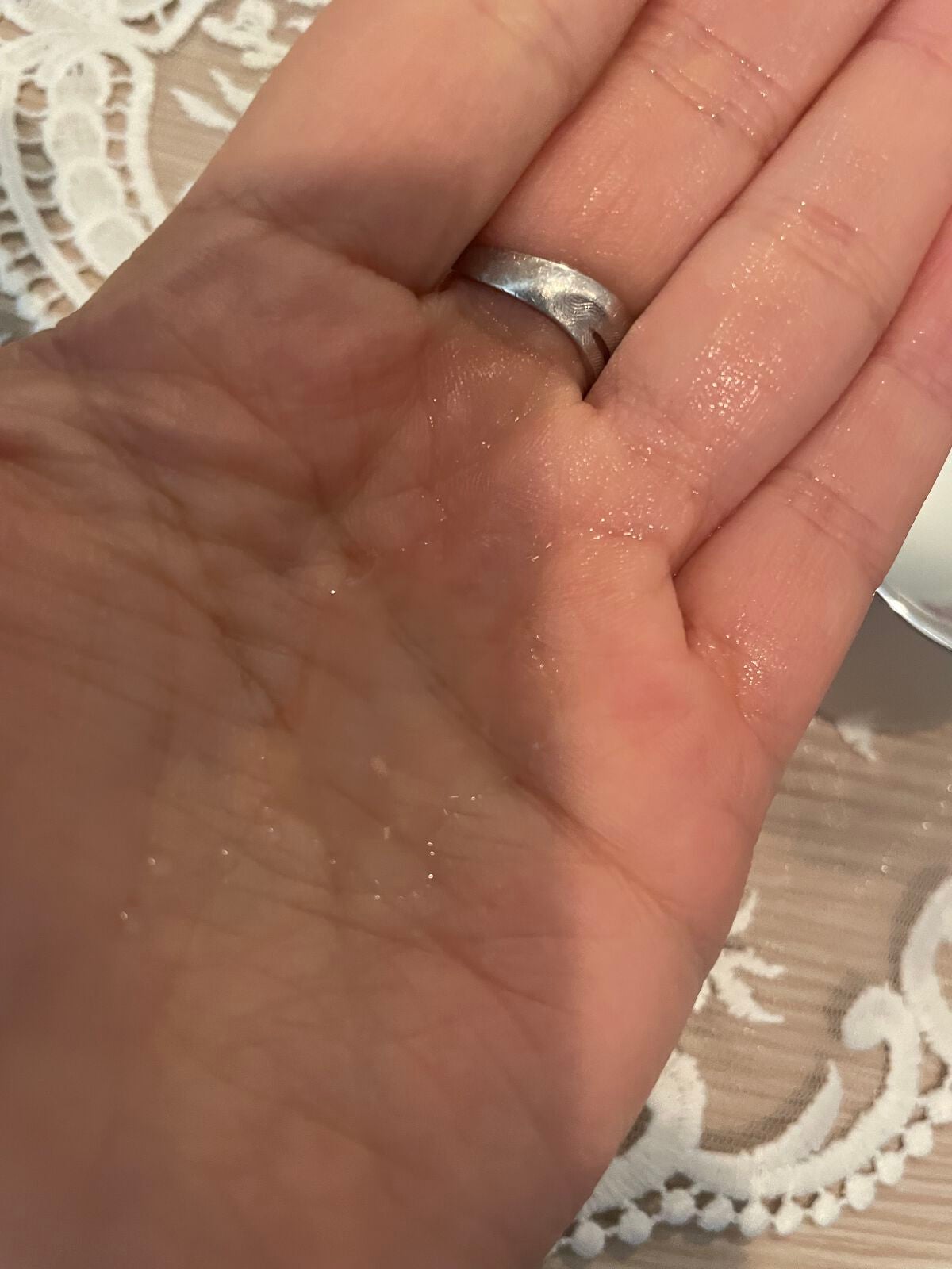 バイオ コンディショニング エッセンス/IOPE/ブースター・導入液を使ったクチコミ(2枚目)