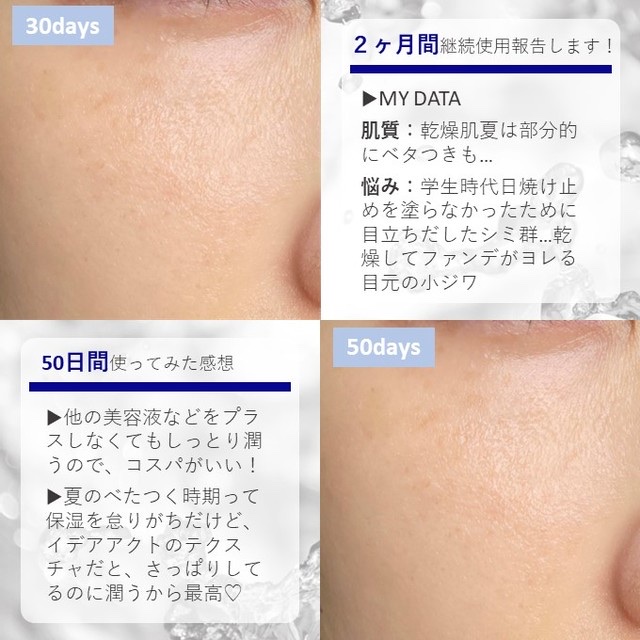 プラチナVCセラム/イデアアクト/美容液を使ったクチコミ（2枚目）