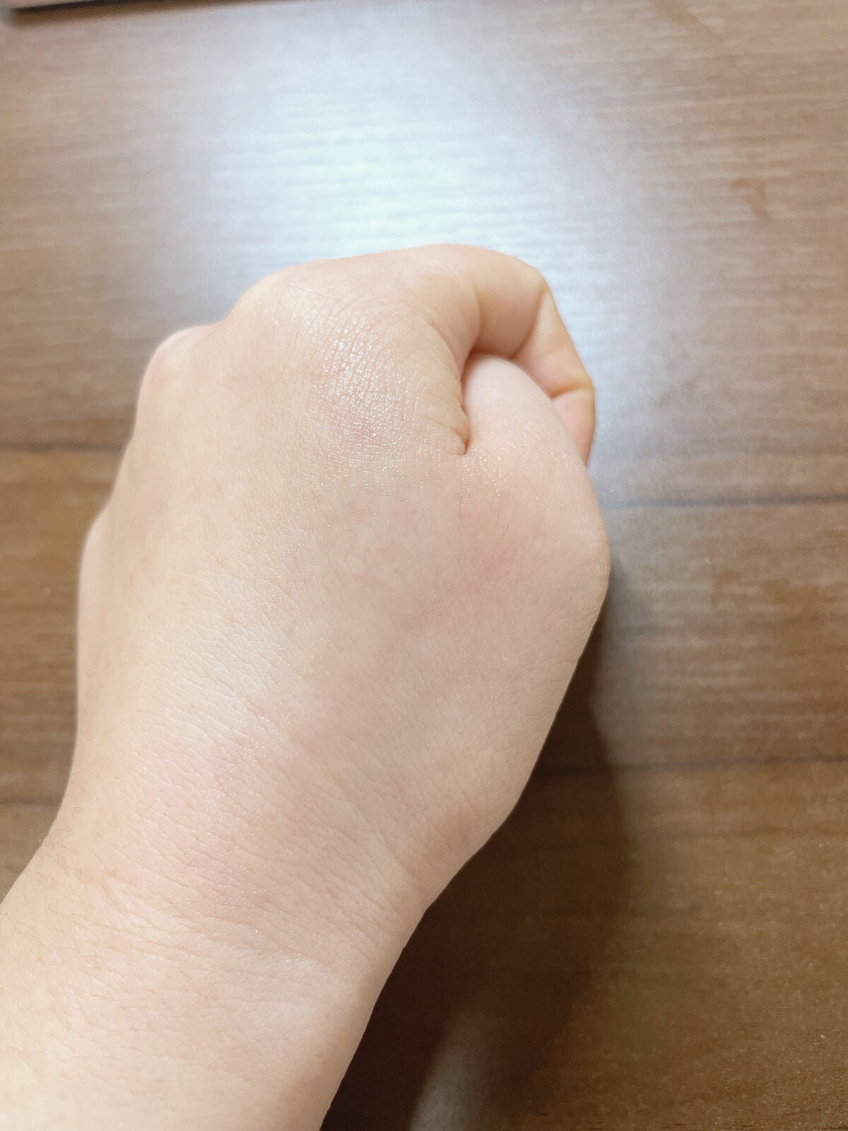 ピュアフィットシカクリーム (Pure Fit Cica Cream)/COSRX/フェイスクリームを使ったクチコミ(4枚目)