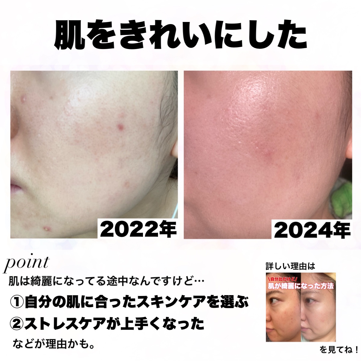 トリートメント クレンジング ミルク/COVERMARK/ミルククレンジングを使ったクチコミ（3枚目）