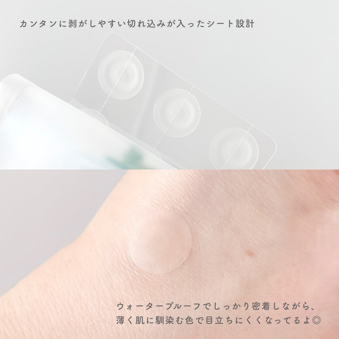 プロCICA クリアスポットパッチ/VT/その他スキンケアを使ったクチコミ(4枚目)