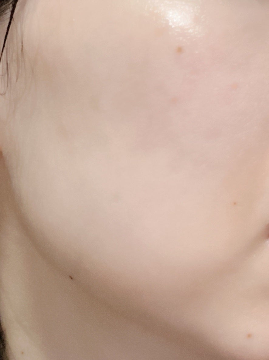 オイデルミン エッセンスローション/SHISEIDO/化粧水を使ったクチコミ(2枚目)