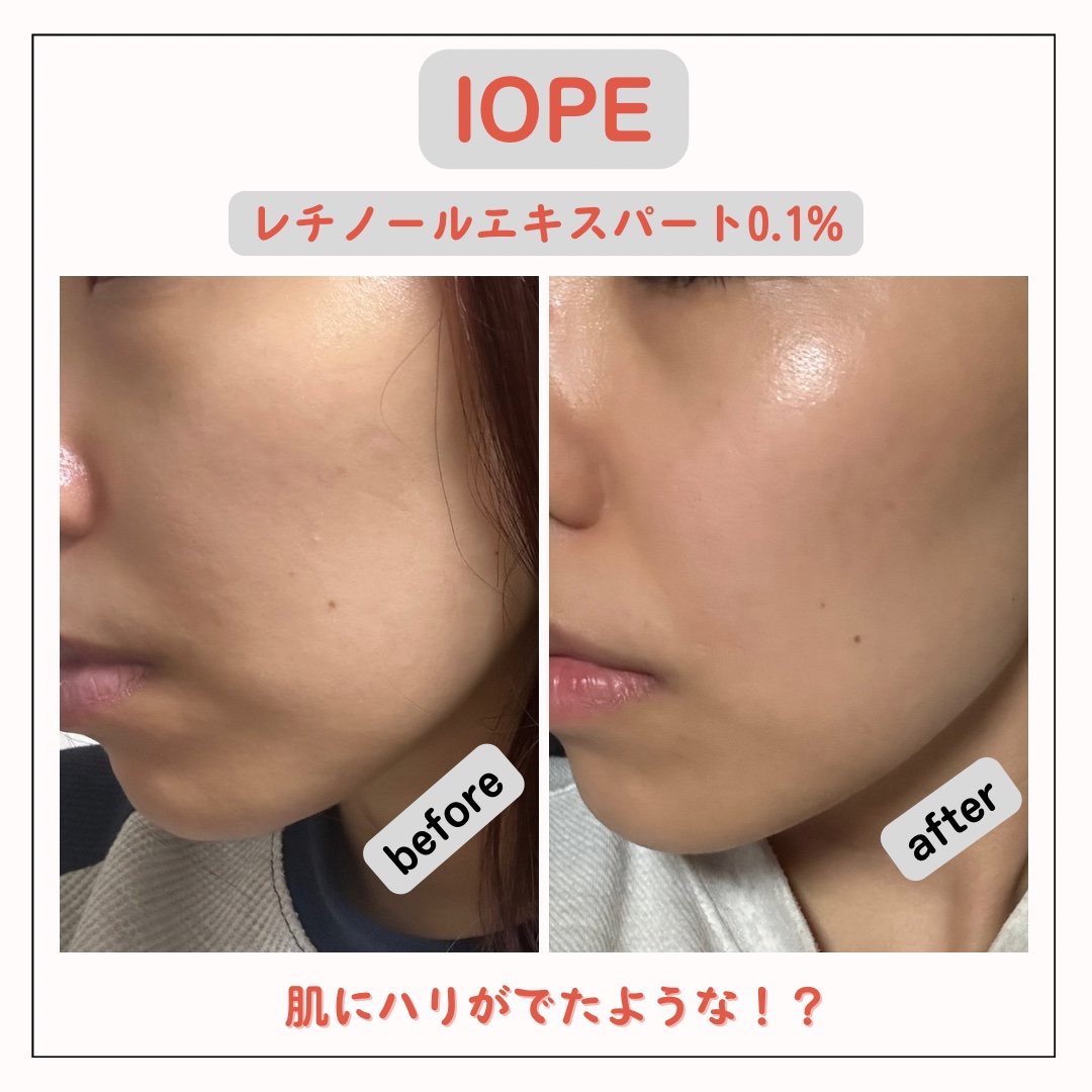 レチノール エキスパート0.1%/IOPE/美容液を使ったクチコミ（3枚目）