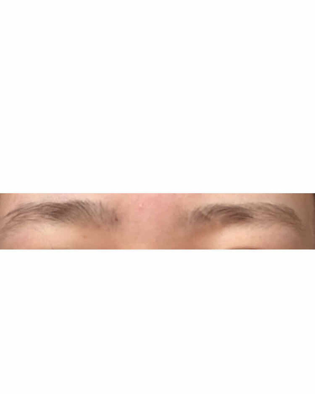 脱色クリーム 敏感肌用/エピラット/ムダ毛ケアを使ったクチコミ（3枚目）