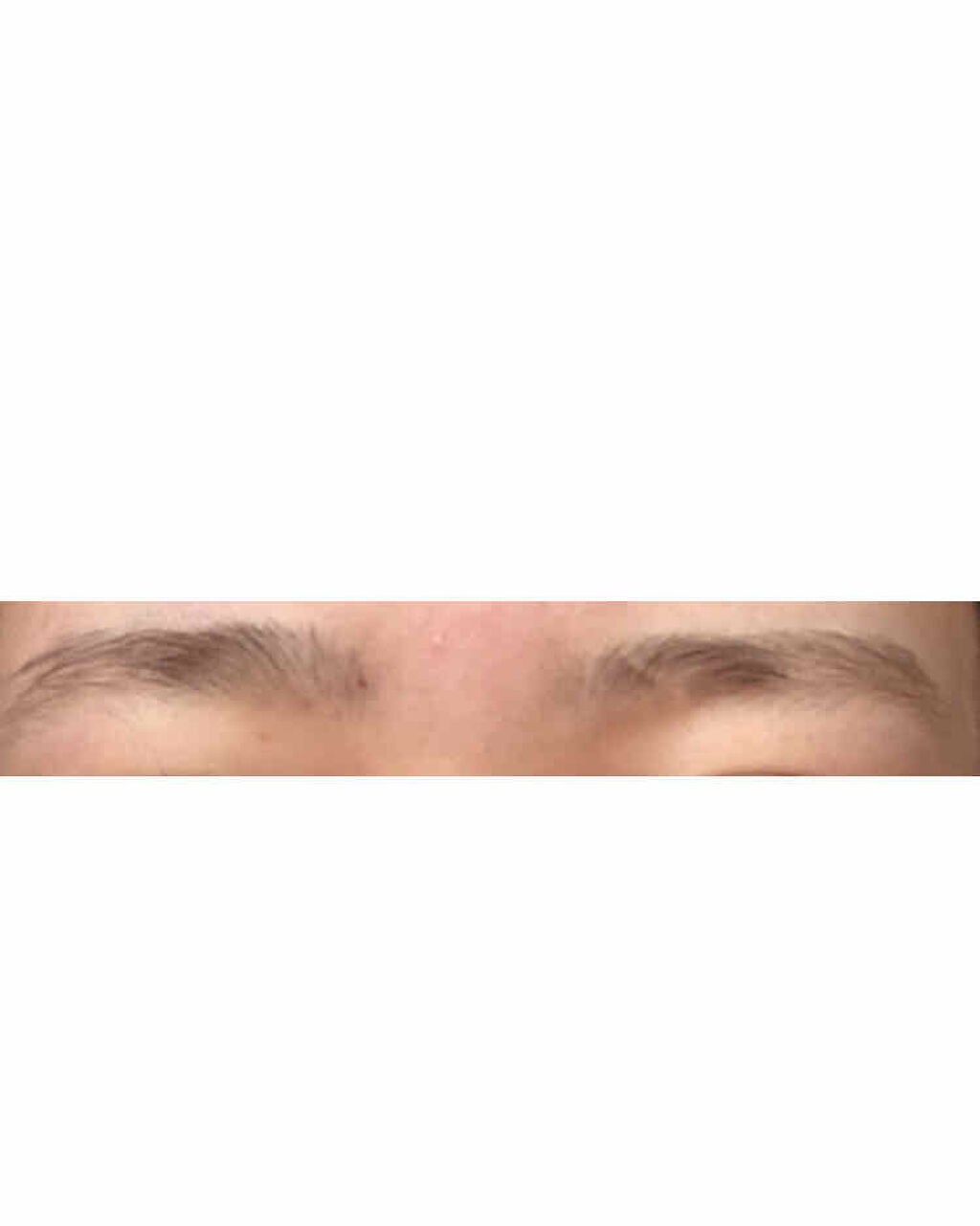 脱色クリーム 敏感肌用/エピラット/ムダ毛ケアを使ったクチコミ(3枚目)