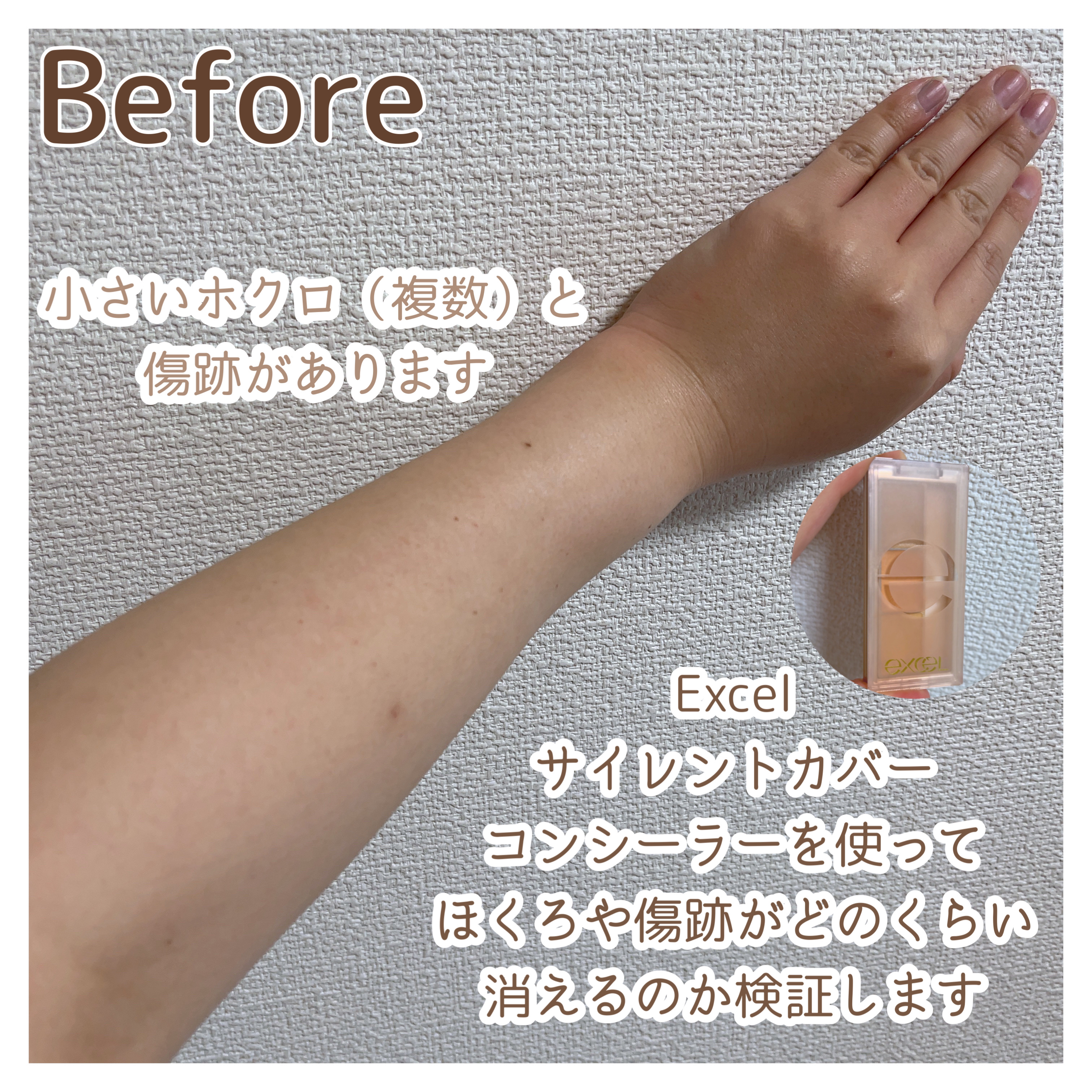 サイレントカバー コンシーラー/excel/パレットコンシーラーを使ったクチコミ（1枚目）