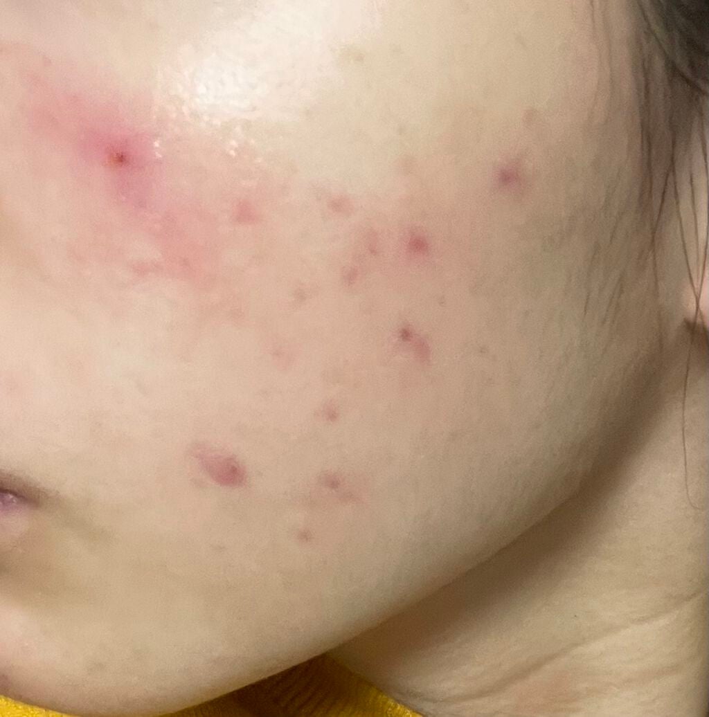 潤浸保湿 フェイスクリーム/キュレル/フェイスクリームを使ったクチコミ(2枚目)