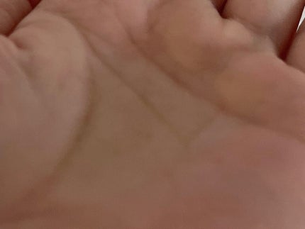 ドクダミ 77 スージングトナー/Anua/化粧水を使ったクチコミ(4枚目)