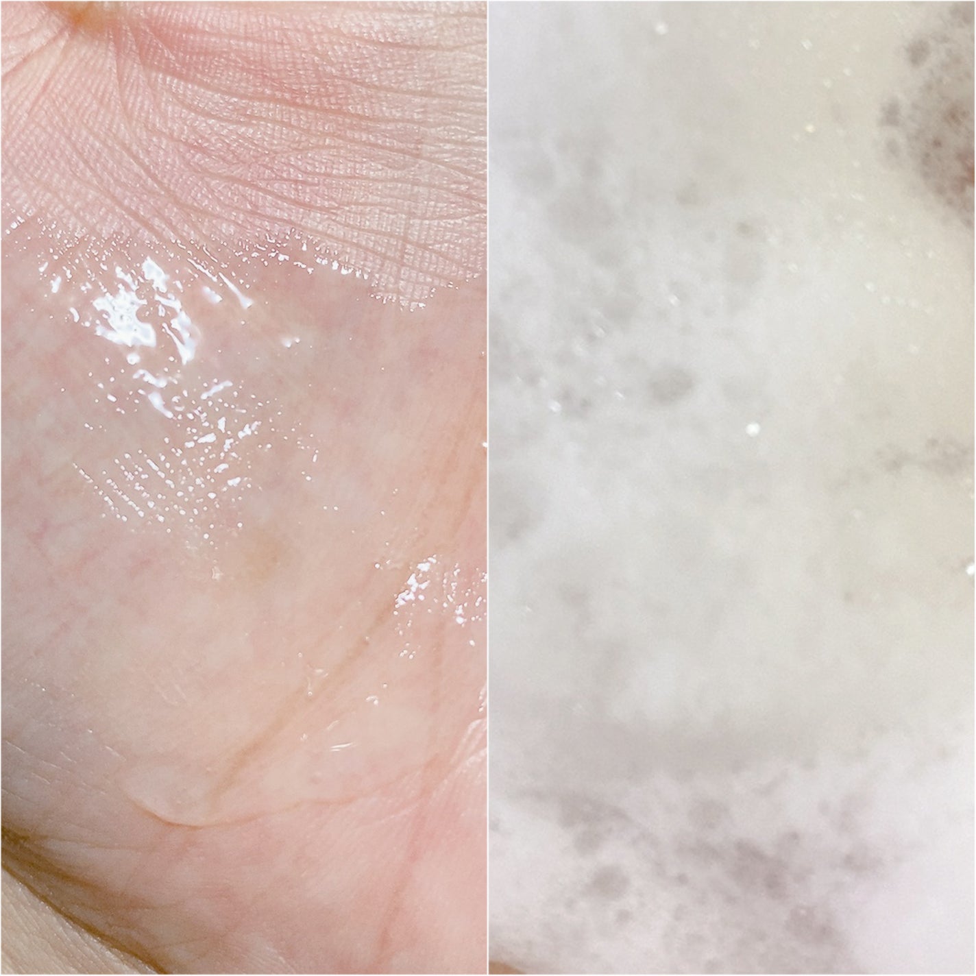 薬用マイルドケアウォッシュ/DELIWHITE/デリケートゾーンケアを使ったクチコミ(3枚目)