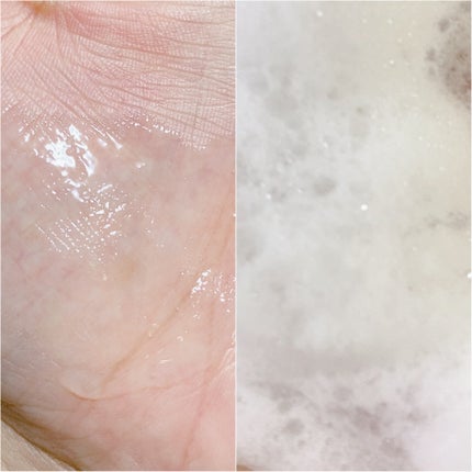 薬用マイルドケアウォッシュ/DELIWHITE/デリケートゾーンケアを使ったクチコミ(3枚目)