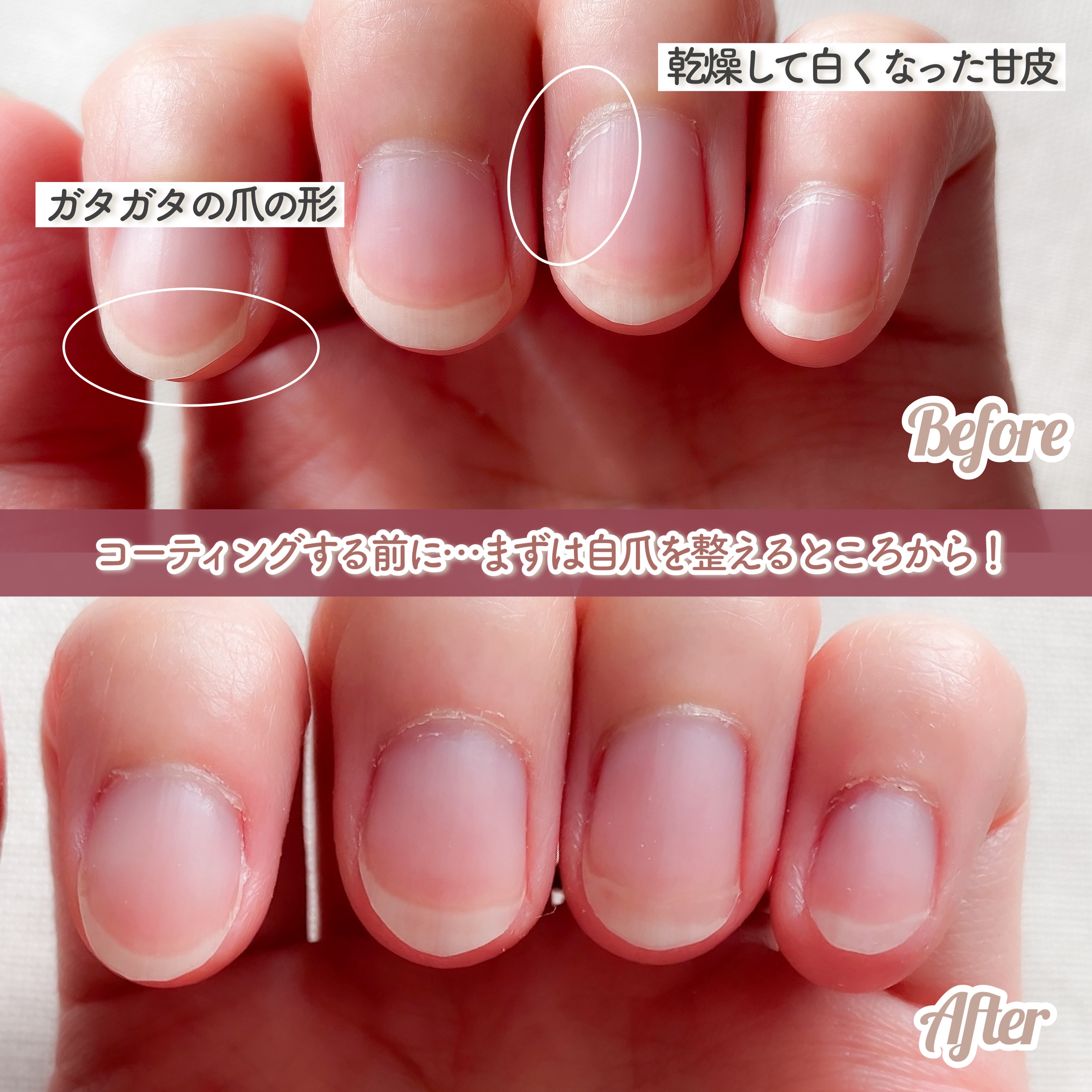 ストロングガード/D-UP/ネイル・ネイルケアを使ったクチコミ（2枚目）